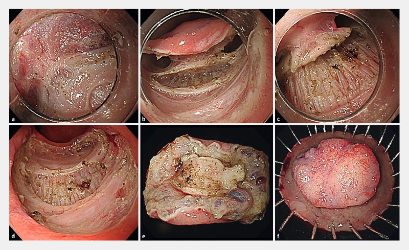 Fig. 2 a 