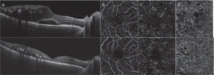 Fig.2