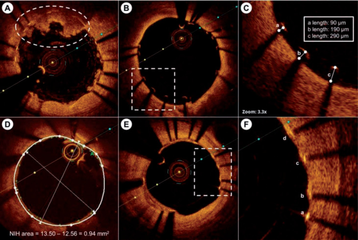 Fig.3