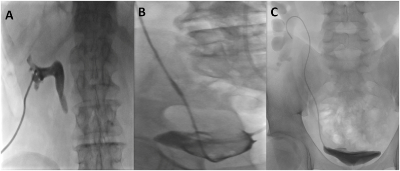 Fig. 1