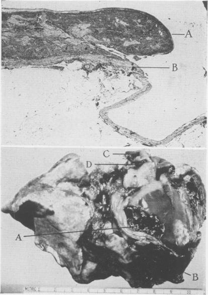 Fig. 4., Fig. 5.