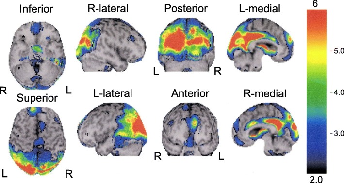 Fig. 2