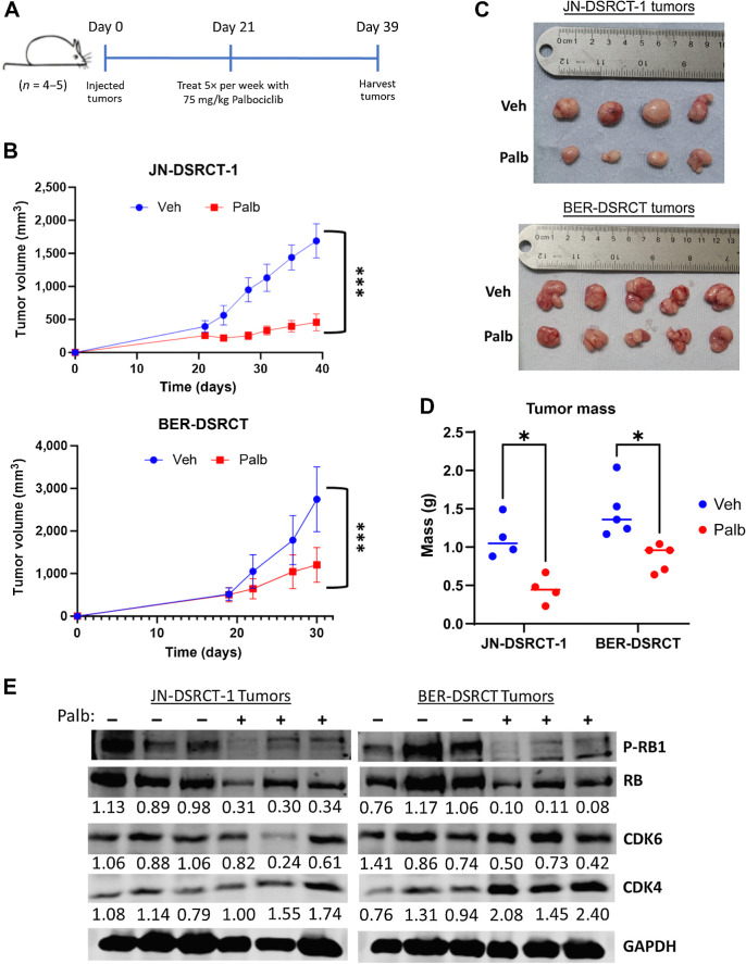 Figure 7. Palbociclib reduces DSRCT xenograft growth. A, Timeline of xenograft injection and palbociclib treatment. B, Tumor growth monitored twice weekly with calipers in JN-DSRCT-1 (n = 4) and BER-DSRCT (n = 5) tumors. C, Image of final tumor volumes treated with vehicle or palbociclib. D, Final tumor mass of xenografts treated with vehicle or palbociclib for 2 weeks (BER-DSRCT) or 3 weeks (JN-DSRCT-1). E, Western blot analysis of RB phosphorylation, CDK4, and CDK6 in xenograft tumors treated with vehicle (−) or palbociclib (+; n = 3). Phosphorylated RB fraction was determined by quantifying pRB S708 relative to total RB and normalizing to the untreated condition. Protein expression of CDK4 and CDK6 was quantified relative to GAPDH and normalized to the untreated condition. Quantifications are shown underneath each blot. *, P < 0.05; ***, P < 0.001.