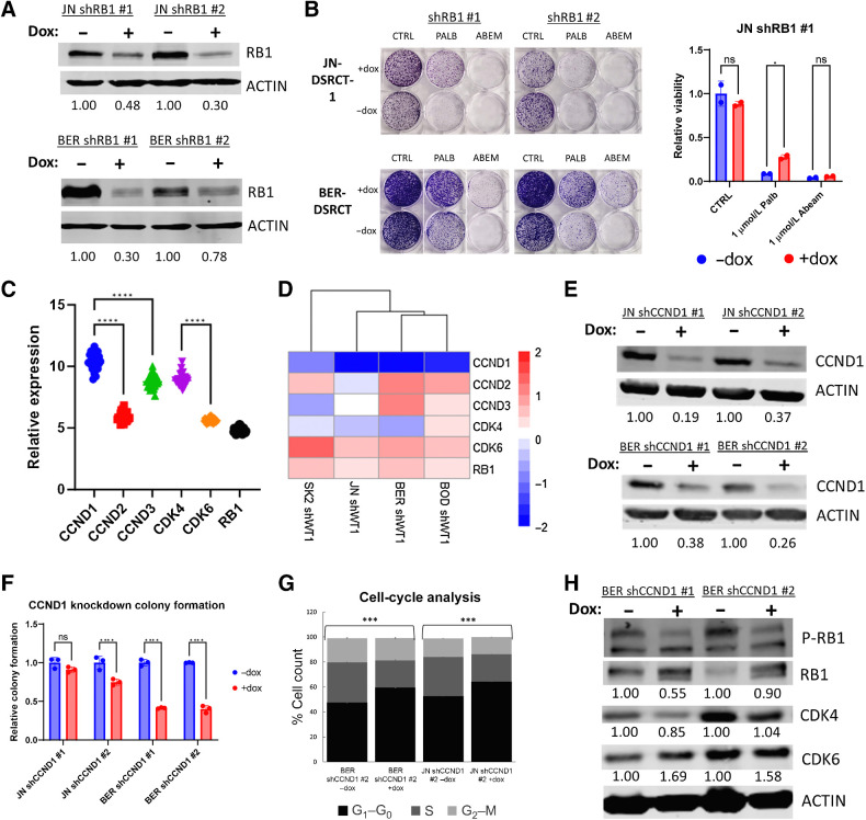 Figure 4. Palbociclib acts through the CCND-CDK4/6-RB axis. A, Western blot analysis of RB1 and ACTIN protein expression in shRB1 cell lines with (+) or without (−) dox (representative blot, n = 2). Average protein expression was quantified relative to ACTIN, normalized to the -dox condition, and is shown underneath each blot. B, Colony formation assays of shRB1 cell lines treated with or without dox in combination with vehicle control, 1 μmol/L palbociclib, or 1 μmol/L abemaciclib. C, Microarray expression analysis of 28 DSRCT tumors comparing CCND and CDK4/6 RNA levels. D, Heatmap of log2-fold change in expression of CCND–CDK4/6–RB pathway members when EWSR1::WT1 is depleted from shWT1 DSRCT cell lines. E, Western blot of CCND1 and ACTIN protein expression in shCCND1 cell lines with (+) or without (−) dox (representative blot, n = 2). Average protein expression was quantified relative to ACTIN, normalized to the -dox condition, and is shown underneath each blot. F, Colony-formation assays of shCCND1 DSRCT cells with or without dox treatment (n = 3). G, Cell-cycle analysis of shCCND1 DSRCT cells with or without dox treatment (n = 3). H, Western blot analysis of RB phosphorylation in BER-DSRCT shCCND1 cells with (+) or without (−) dox (representative blot, n = 2). Phosphorylated RB fraction was determined by quantifying pRB S708 relative to total RB and normalizing to the -dox condition. Average protein expression of CDK4 and CDK6 was quantified relative to ACTIN and normalized to the -dox condition. Quantifications are shown underneath each blot. ***, P < 0.001; ****, P < 0.0001; ns, nonsignificant.