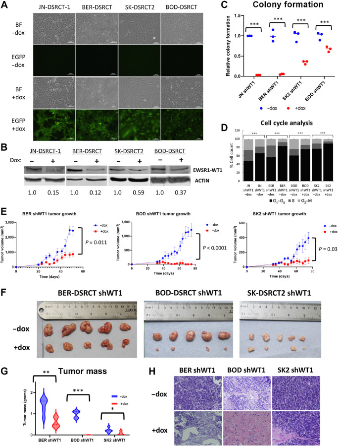 Figure 1. EWSR1::WT1 is essential for DSRCT growth. A, Brightfield and fluorescent images of dox-inducible shWT1 DSRCT cell lines treated with or without dox that selectively induces GFP and shRNA expression. B, Western blot analysis of EWSR1::WT1 and ACTIN protein expression in shWT1 cell lines treated with (+) or without (−) dox for 4 days (representative blot, n = 2). Average protein expression was quantified relative to ACTIN, normalized to the -dox condition, and is shown underneath each blot. C, Quantification of colony formation assays of shWT1 cell lines treated with (red) or without dox (blue; n = 3). D, Cell-cycle analysis of DSRCT shWT1 cells treated with or without dox for 4 days. E, Growth of DSRCT shWT1 tumors with or without dox treatment (n = 5). F, Images of final DSRCT shWT1 tumors treated with or without dox. G, Final tumor mass of DSRCT shWT1 tumors treated with (red) or without (blue) dox. H, Representative H&E staining of DSRCT shWT1 tumors treated with or without dox (n = 3). Scale bar, 50 μm. *, P < 0.05; **, P < 0.01; ***, P < 0.001.