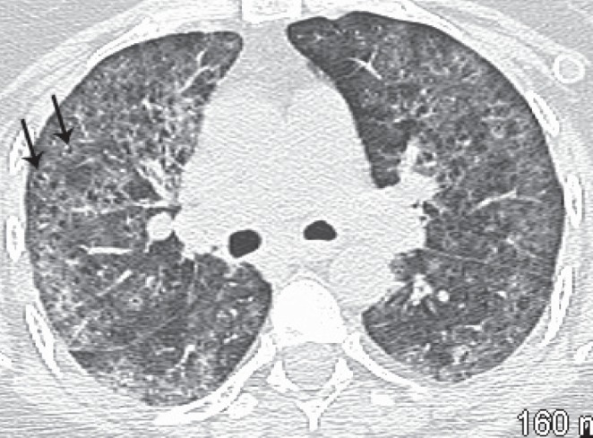 Figure 3)