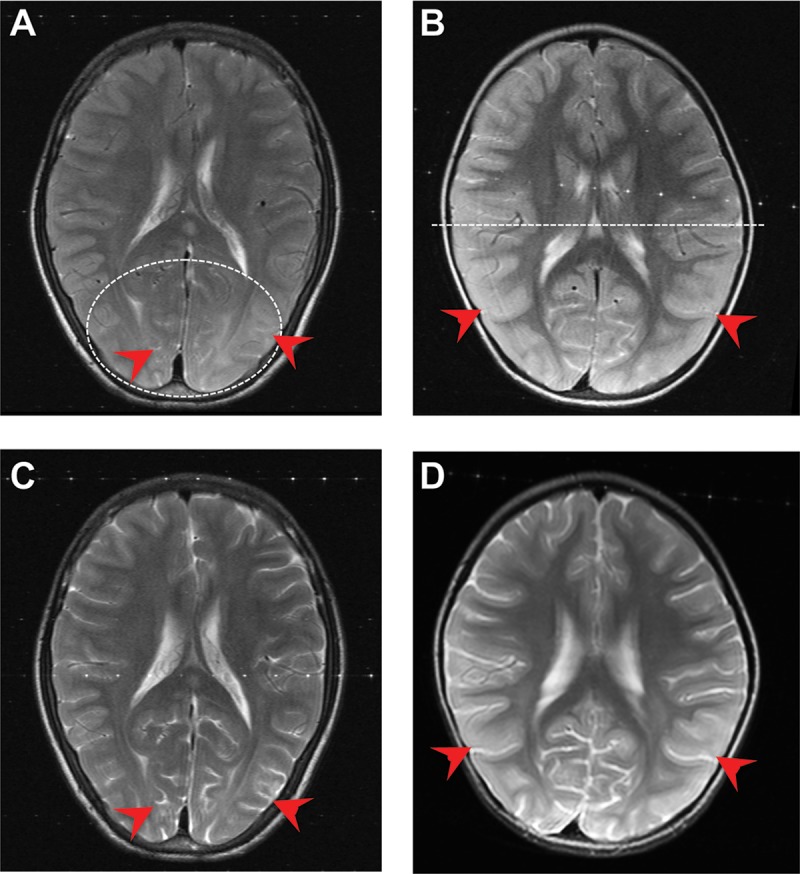 FIG 2 