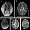 FIG 3