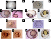 Fig. 12