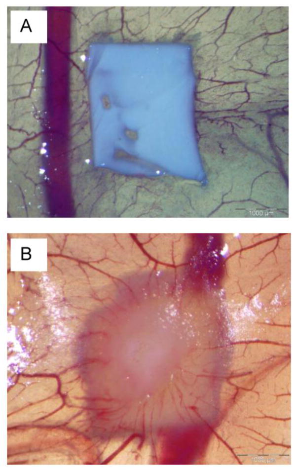 Figure 11