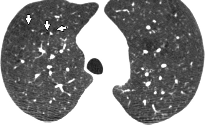 Figure 1c: