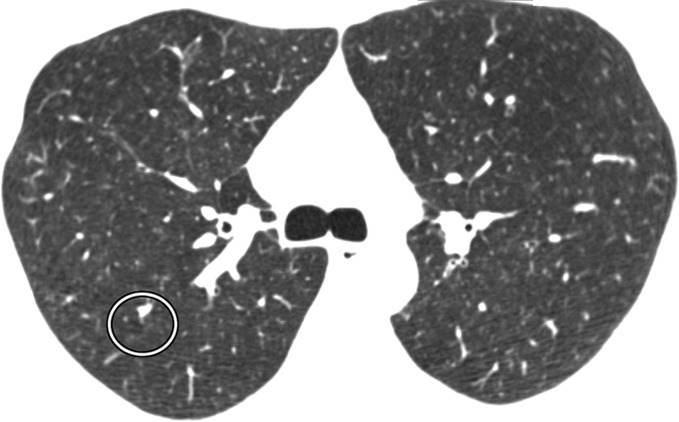 Figure 1b: