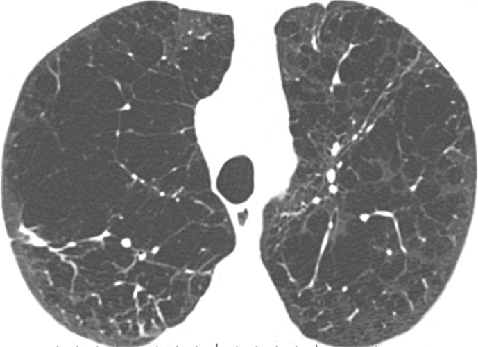 Figure 1f: