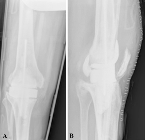 Fig. 4A–B