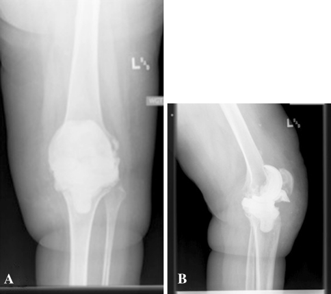 Fig. 1A–B