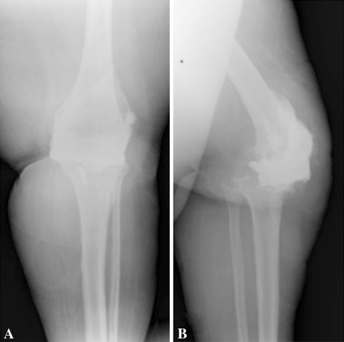 Fig. 3A–B