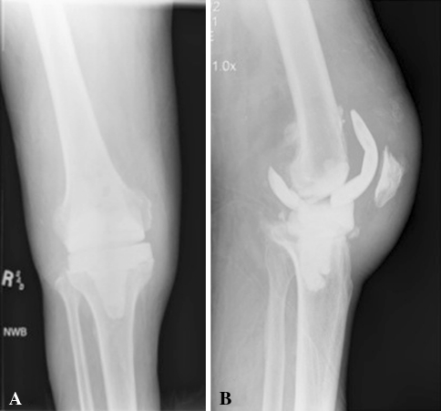 Fig. 2A–B