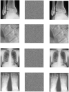 Fig 7