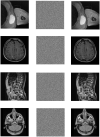 Fig 6