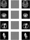 Fig 8