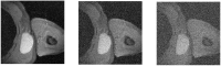 Fig 15