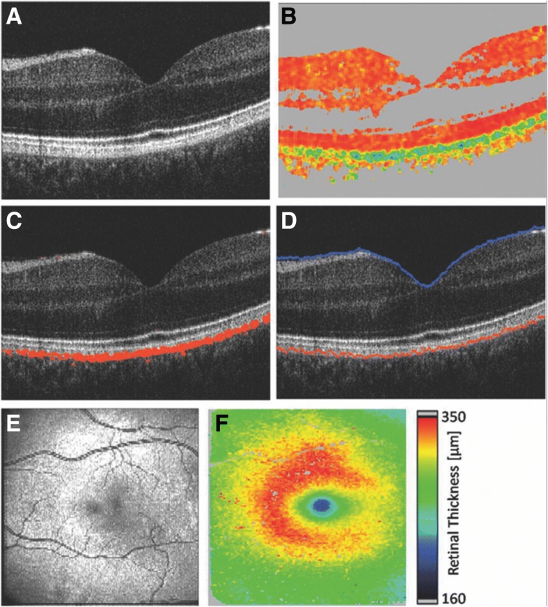 Fig. 4