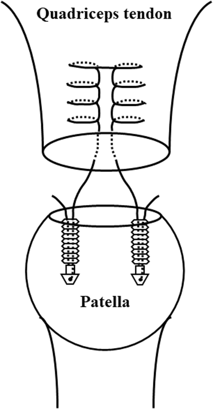 Fig 2