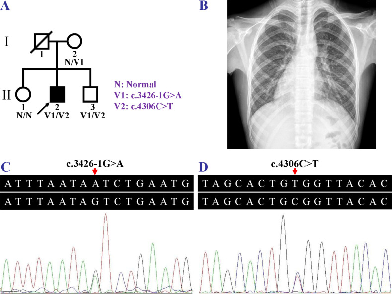 Fig 1