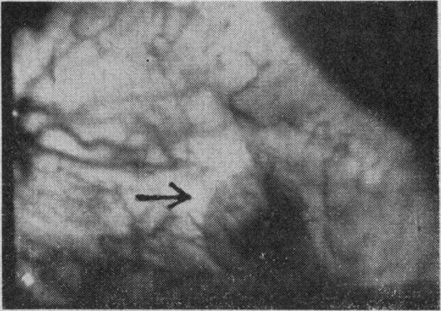 Fig. 10