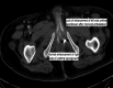 <b>FIG. 3.</b>