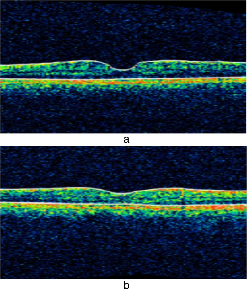 Fig. 3