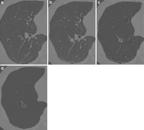 Fig 2