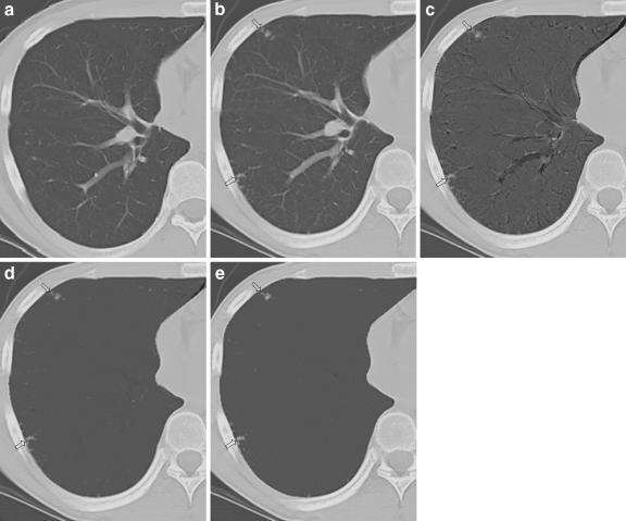 Fig 1