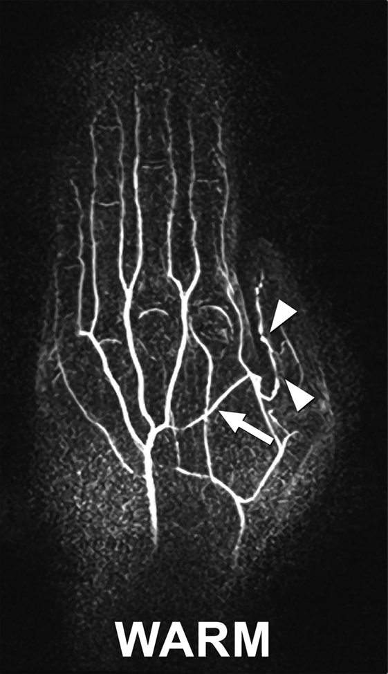 Figure 5b: