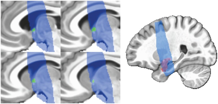 Fig. 2.