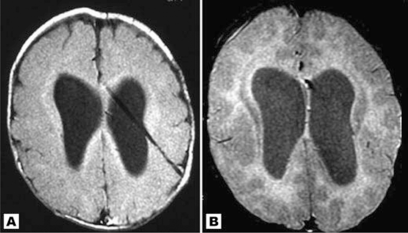 Fig. 11.