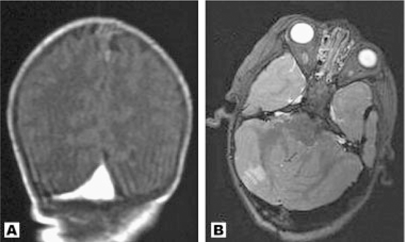 Fig. 10.