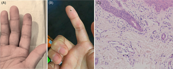 FIGURE 1