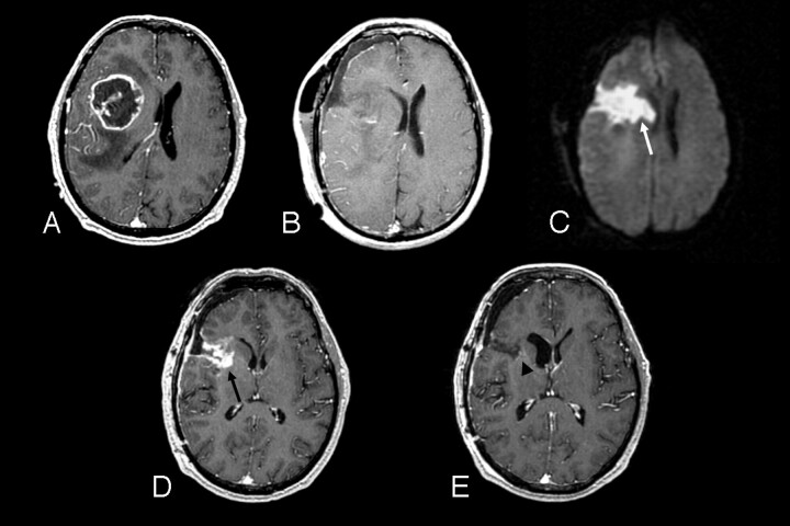 Fig 2.