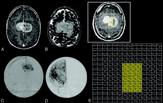 Fig 8.