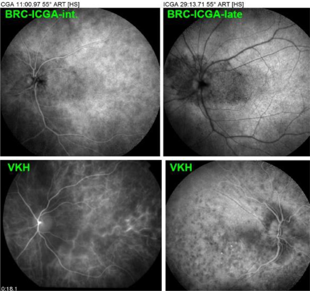 Fig. 11