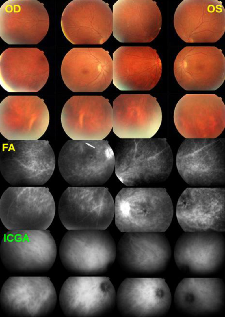 Fig. 1