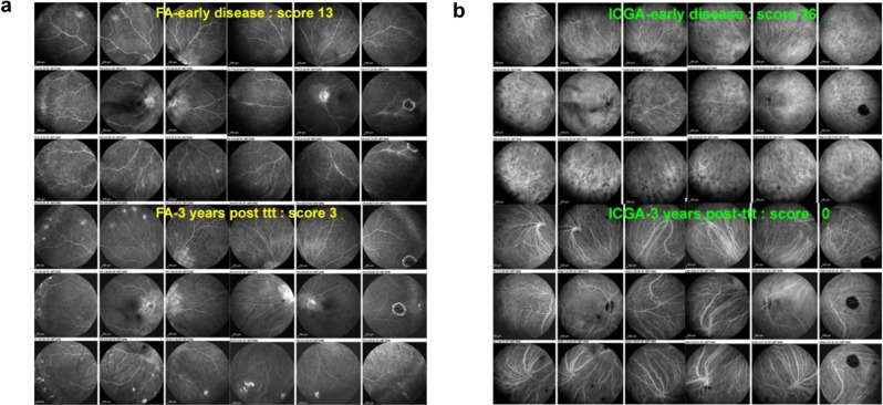 Fig. 14