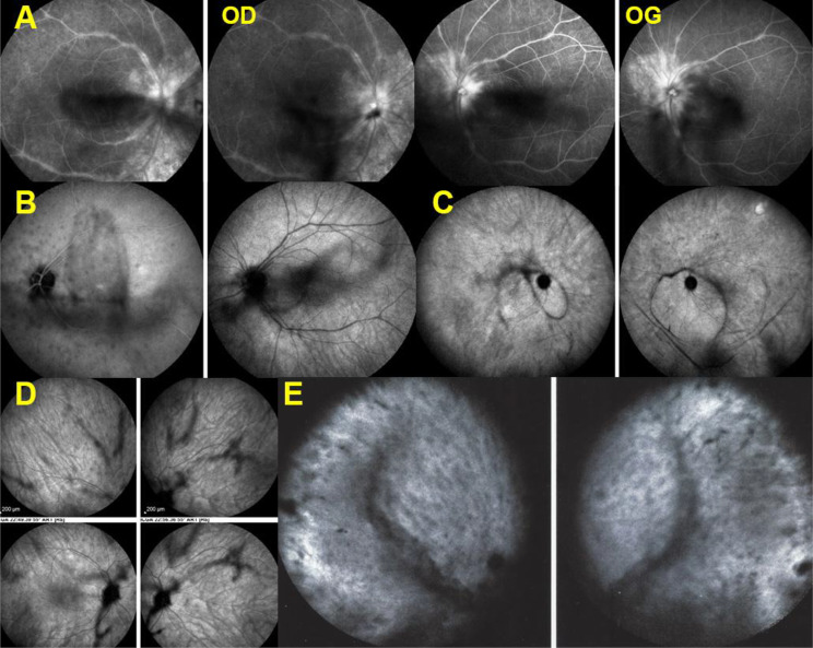 Fig. 12