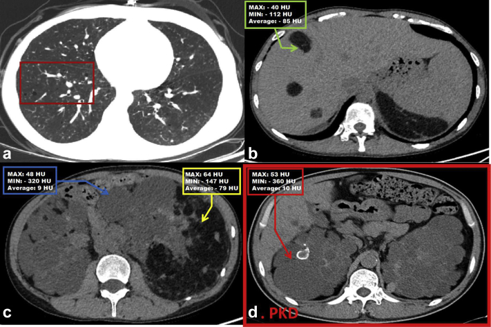 Figure 2