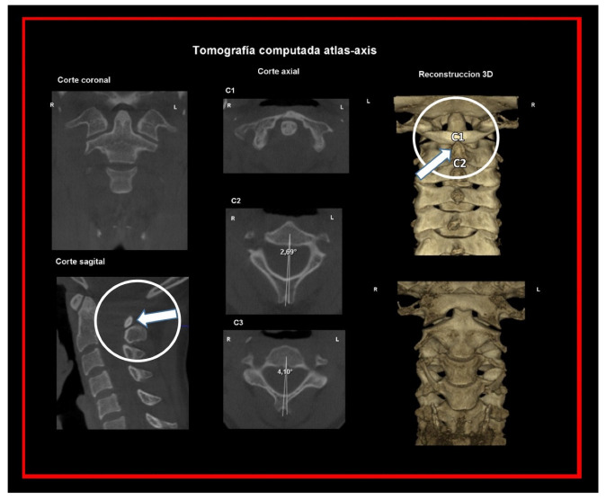 Figure 17