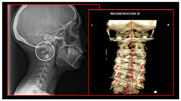 Figure 16