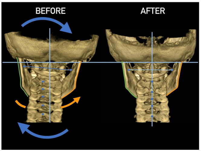 Figure 26