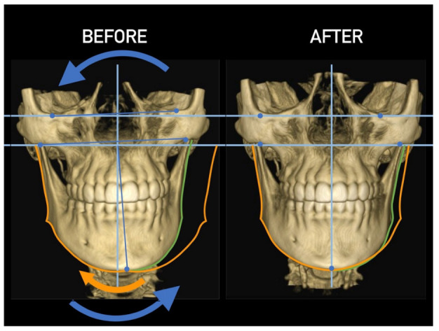 Figure 25