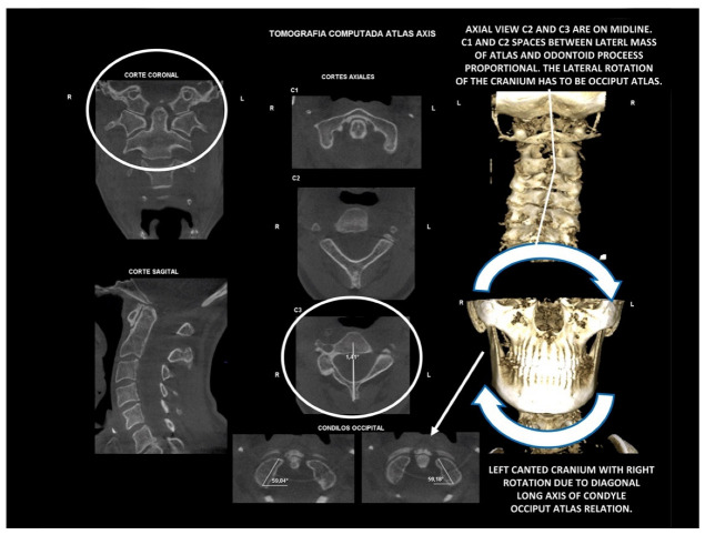 Figure 15